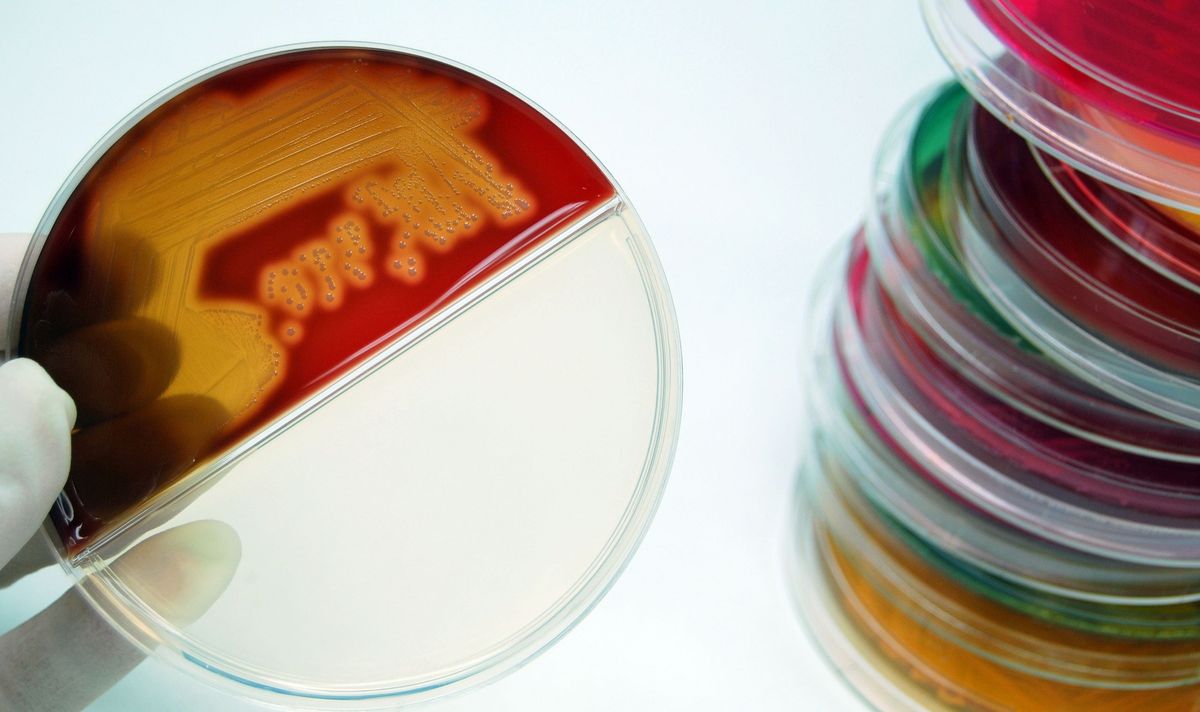 selective-media-culturing