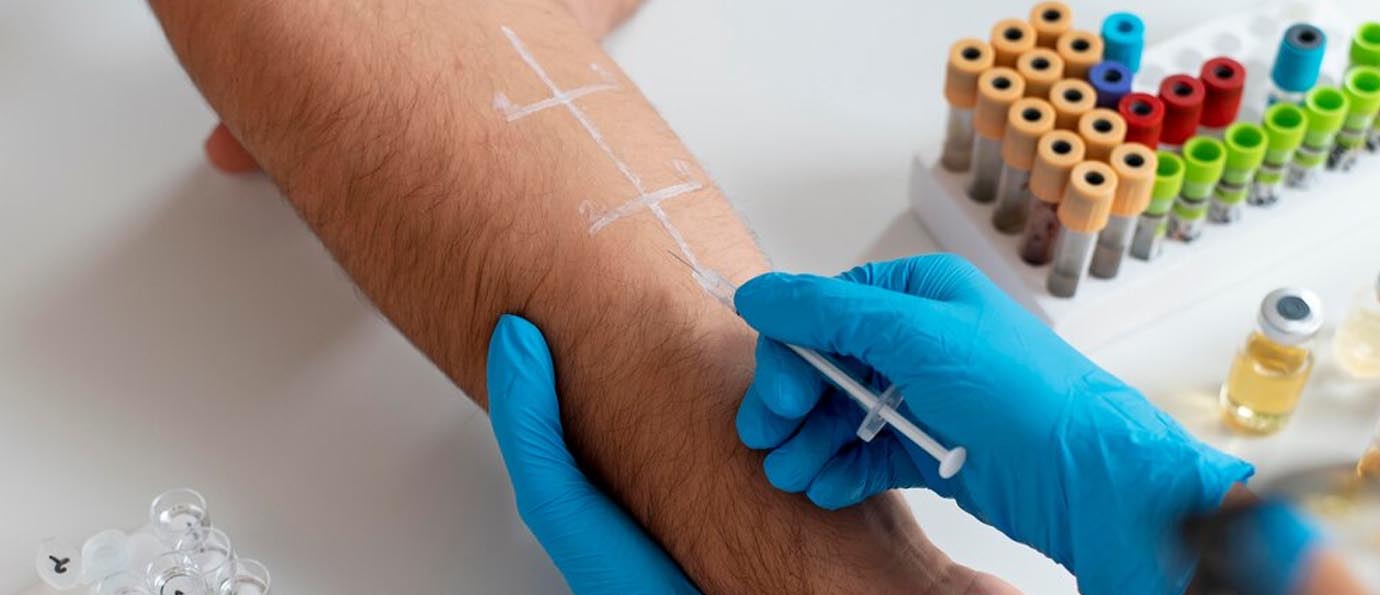 primary-skin-irritation-test
