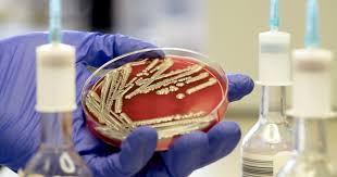 microbial-kill-rate-efficiency-test