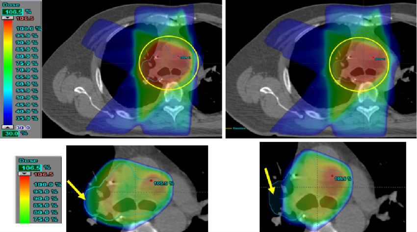 radiation-dose-mapping-test