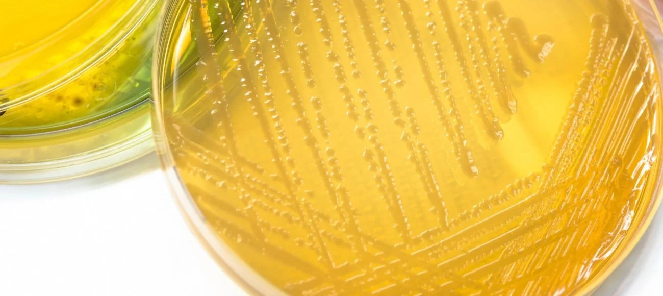 ep-2613-microbiological-examination-of-non-sterile-products-test-for-specified-microorganisms