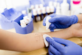 sensitization-tests
