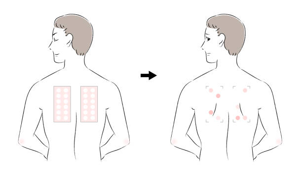phototoxicity-patch-testing