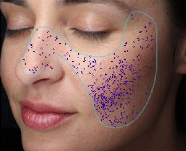 skin-texture-analysis