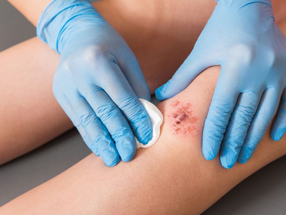 testing-for-skin-healing-and-repair-effects