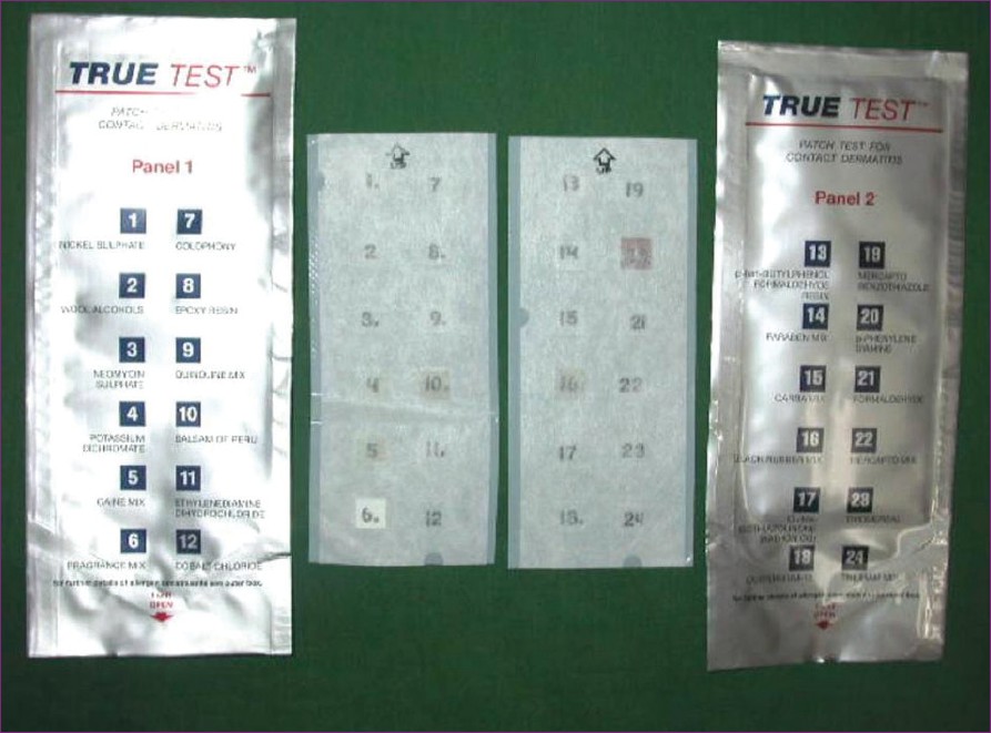 epicutaneous-testing-for-sensitization