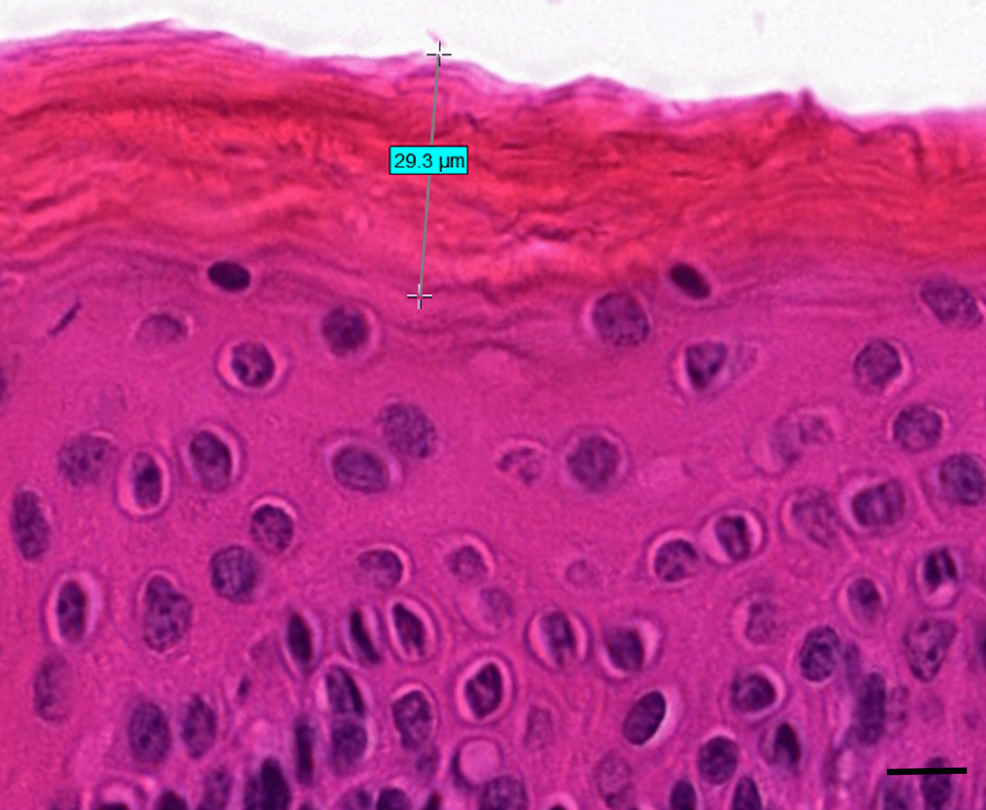 tape-stripping-for-stratum-corneum-assessment