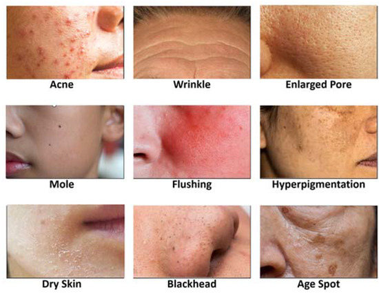 individual-variability-in-skin-responses-to-products