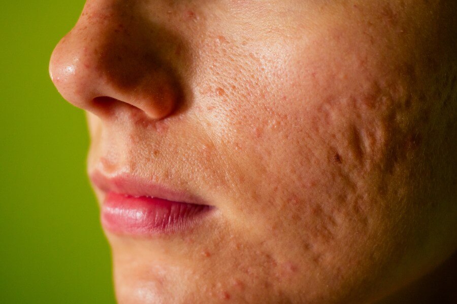variability-in-test-results-due-to-skin-types-and-conditions