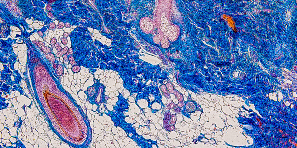oecd-406-skin-sensitization-study-for-azo-compounds