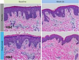 isotr-22219-testing-of-skin-barrier-function