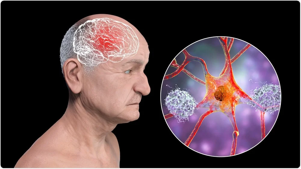 neurotoxicity-effects-on-the-nervous-system