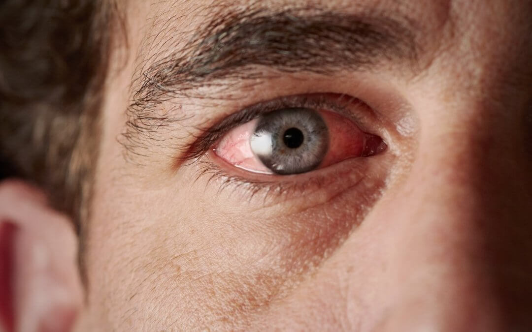 ocular-toxicity-eye-damage-or-irritation