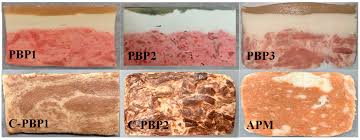 aoac-201809-detection-of-macrolides-in-pork-and-beef