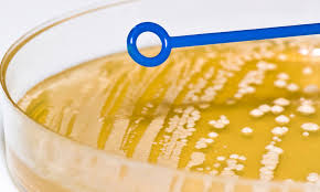 iso-17994-2-comparison-of-microbiological-methods