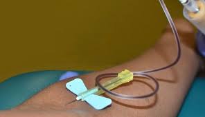 iso-10555-mechanical-testing-of-catheters