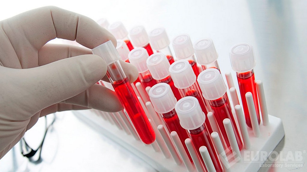 iso-10993-4-fatigue-impact-on-blood-contact