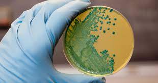 codex-cacgl-63-microbial-risk-assessment-for-ready-meals