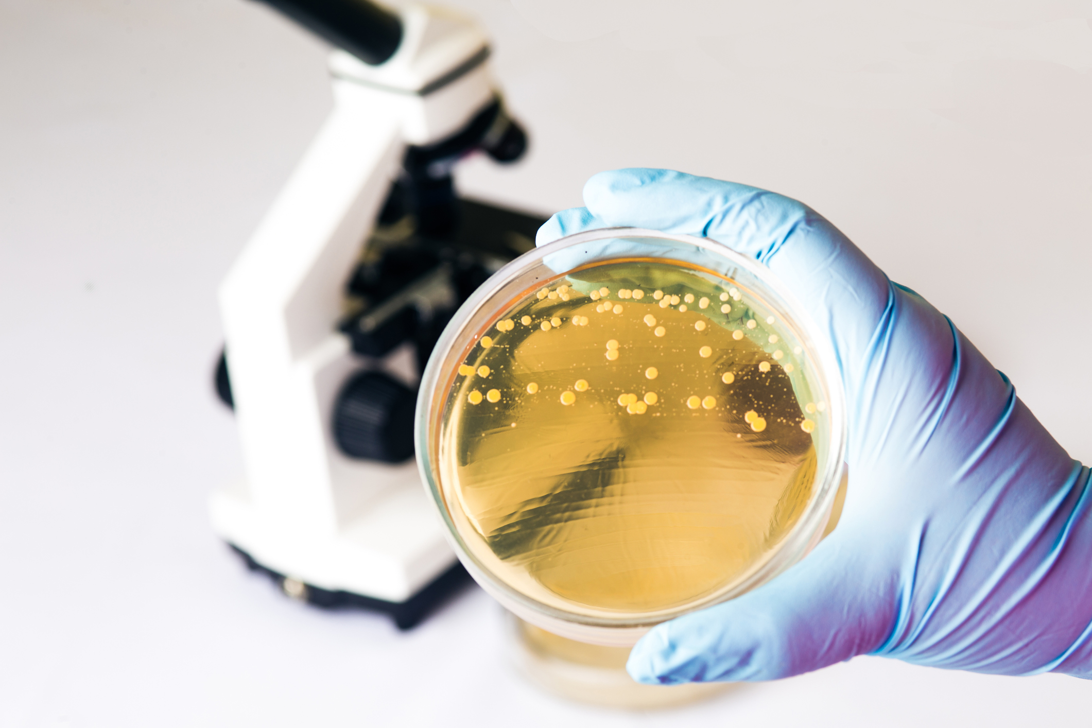 iso-8199-enumeration-of-microbial-indicators